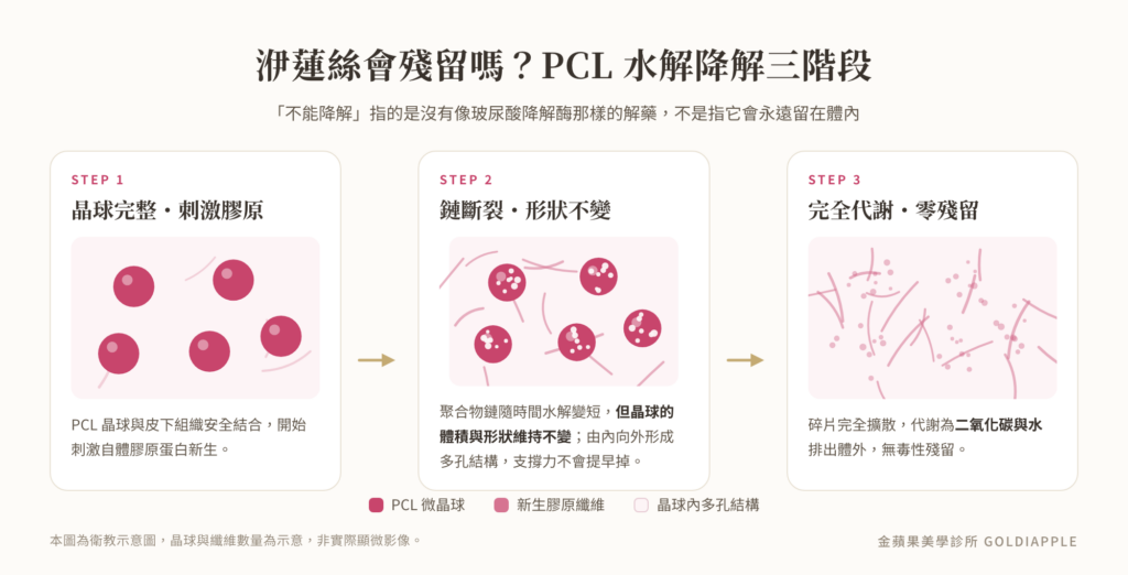Three stages of PCL hydrolysis: microsphere intact, chains break with shape unchanged, fully metabolized into carbon dioxide and water