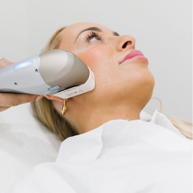 Ultraformer III HIFU 6.0 probe applied to the jowl area, focusing on dissolving fat to improve marionette lines
