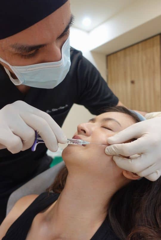 Close-up of a doctor injecting filler into the lower face with a fine needle
