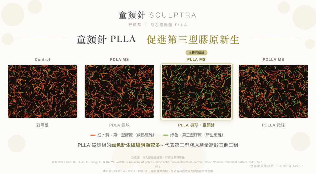 Sculptra collagen production