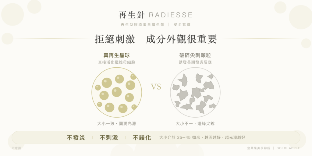 Comparison of Radiesse CaHA microspheres and broken, spiky particles: 25–45 microns, round and smooth, less likely to cause inflammation