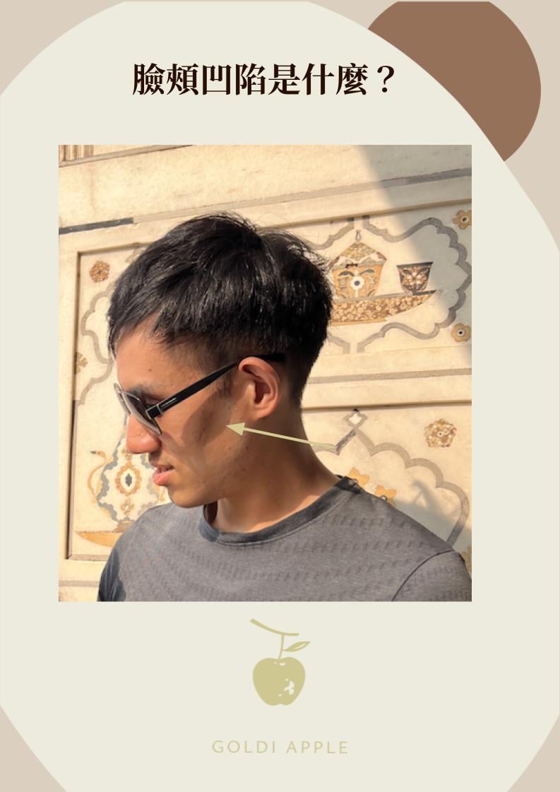 Side-profile photo of Dr. Ou Chia-Hung himself, with an arrow marking the hollow cheek below the cheekbone