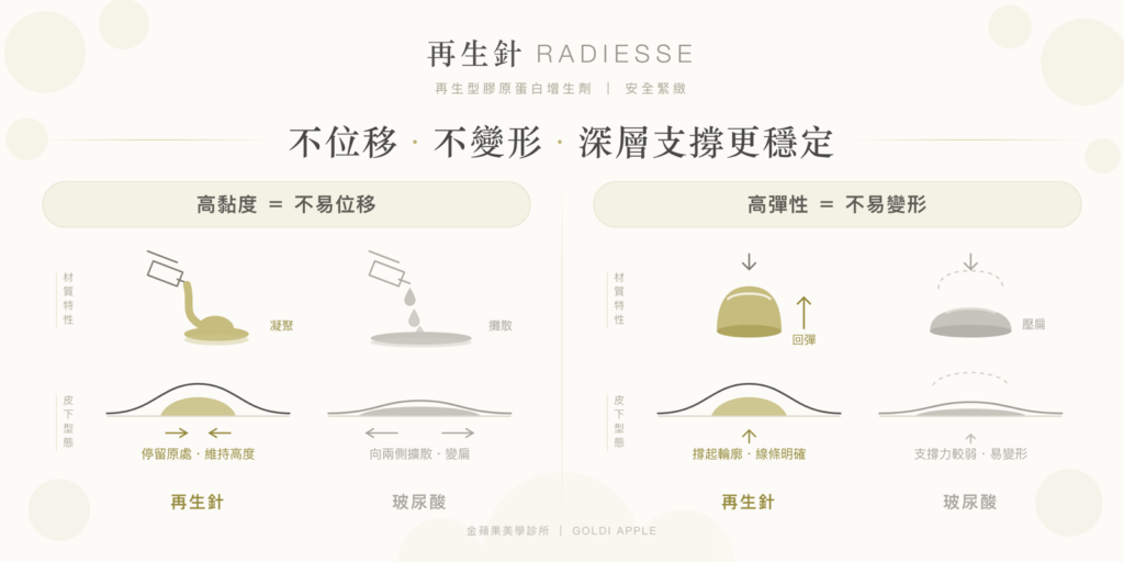 Radiesse versus hyaluronic acid: high viscosity resists shifting, high elasticity resists deformation, giving more stable deep support