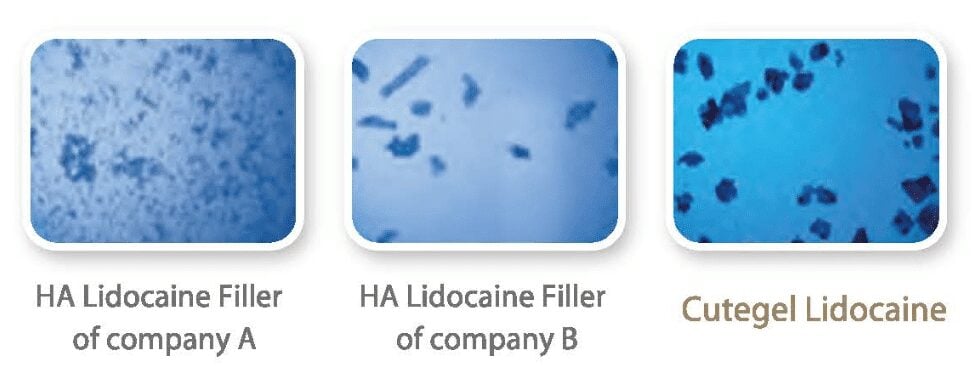 Microscopic particle comparison of three lidocaine-containing hyaluronic acids; Cutegel Lidocaine is on the right
